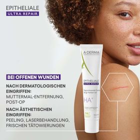 A-DERMA EPITHELIALE ULTRA REPAIR Regenerierende Creme