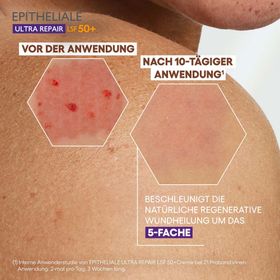 A-DERMA EPITHELIALE ULTRA REPAIR Regenerierende Creme LSF50+