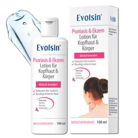 Ekzem & Psoriasis Lotion für Kopfhaut und Körper