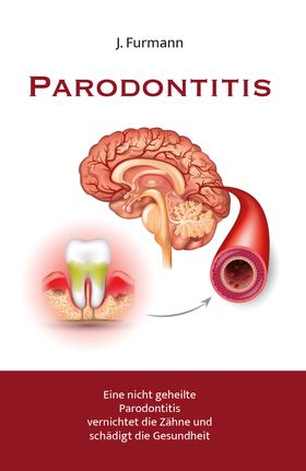 Parodontitis