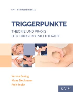 Triggerpunkte