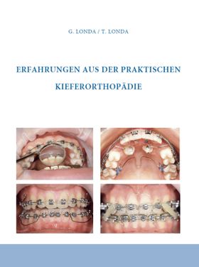 Erfahrungen aus der praktischen Kieferorthopädie