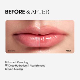 VT COSMETICS Reedle Shot Lippen-Plumper Beginner