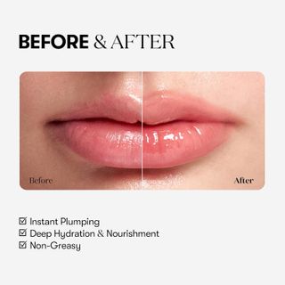 VT COSMETICS Reedle Shot Lippen-Plumper Beginner