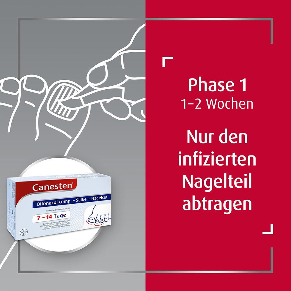 Canesten® Bifonazol comp. – Salbe + Nagelset zur Behandlung von Nagelpilz