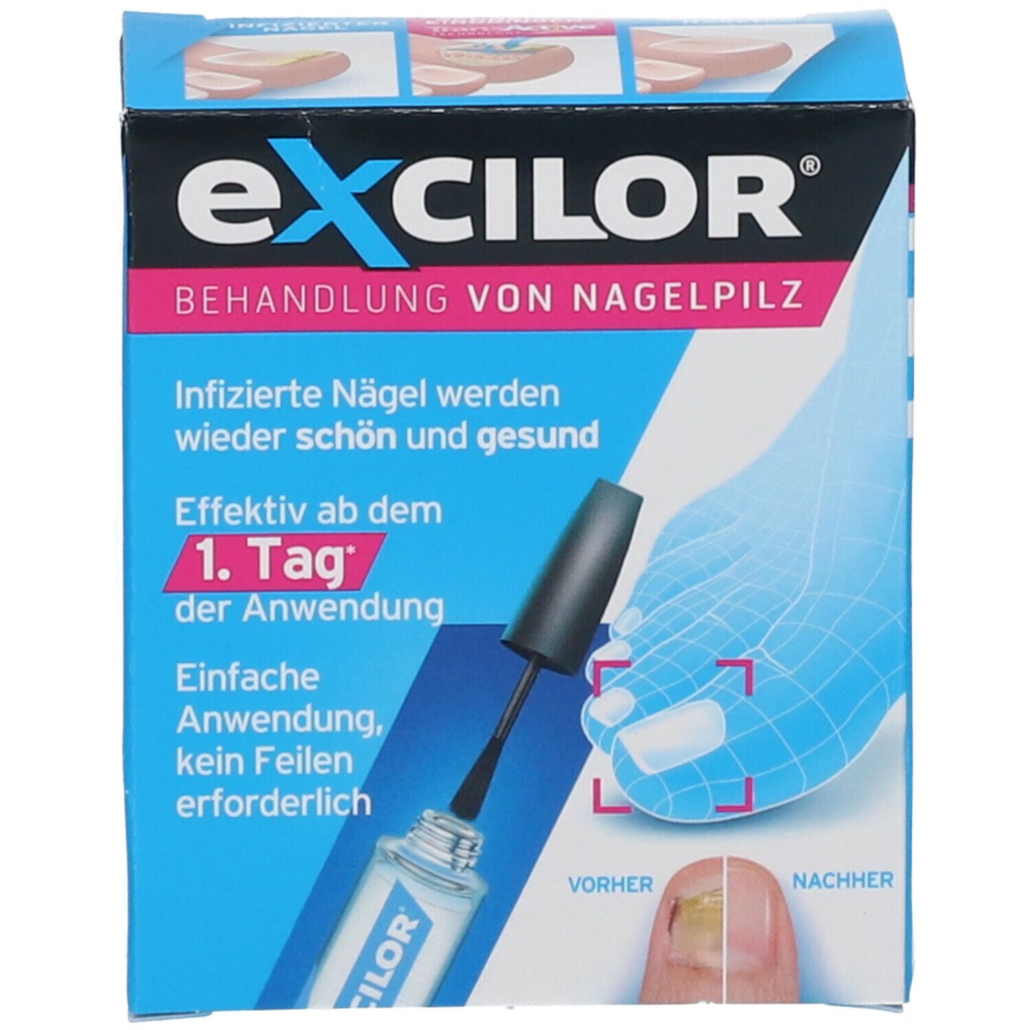 excilor® Nagelpilz-Lösung