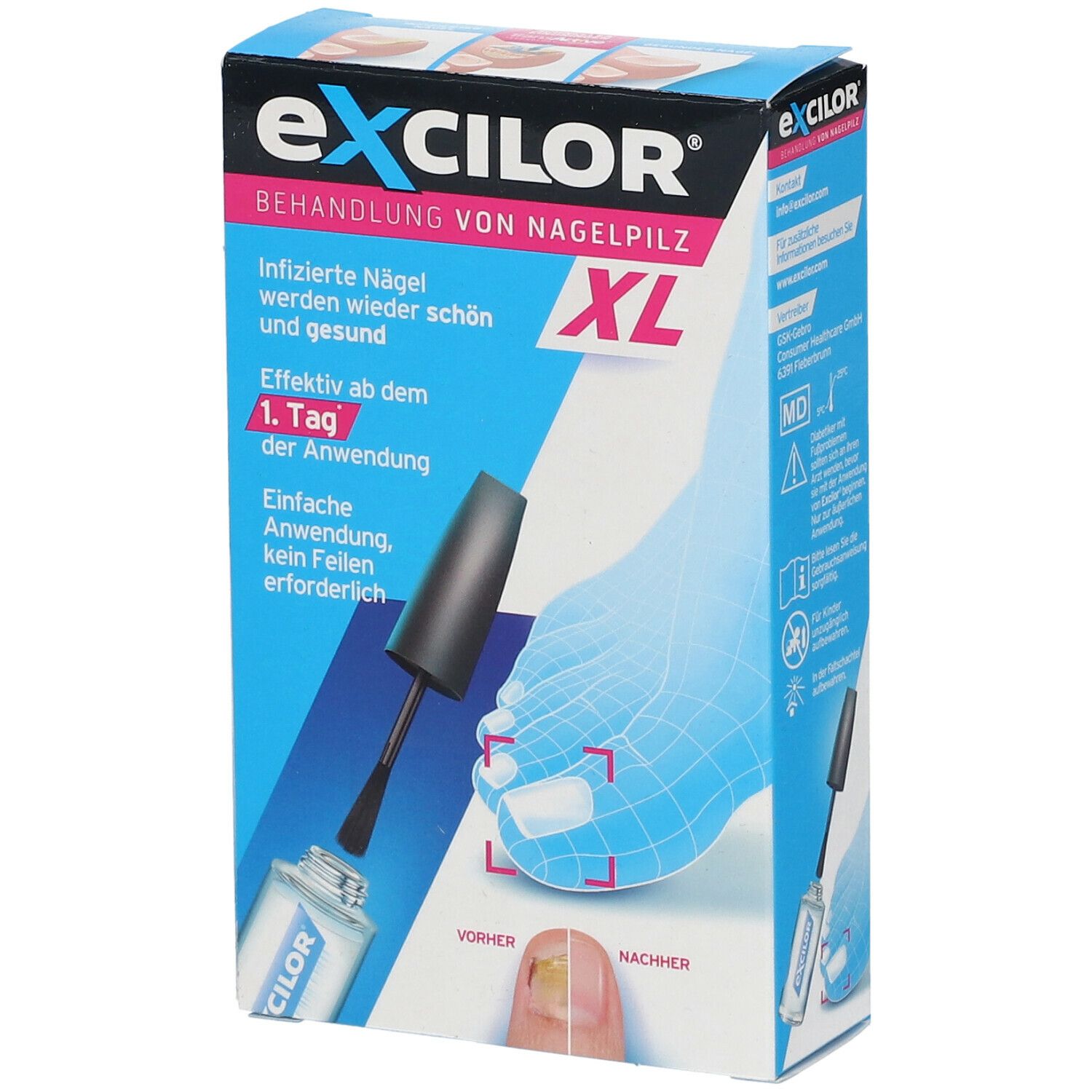 excilor® Lösung gegen Nagelpilz