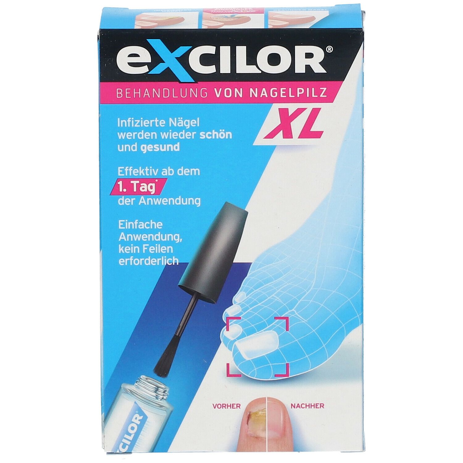 excilor® Lösung gegen Nagelpilz