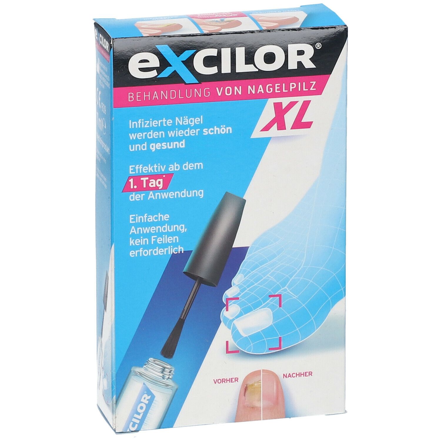 excilor® Lösung gegen Nagelpilz