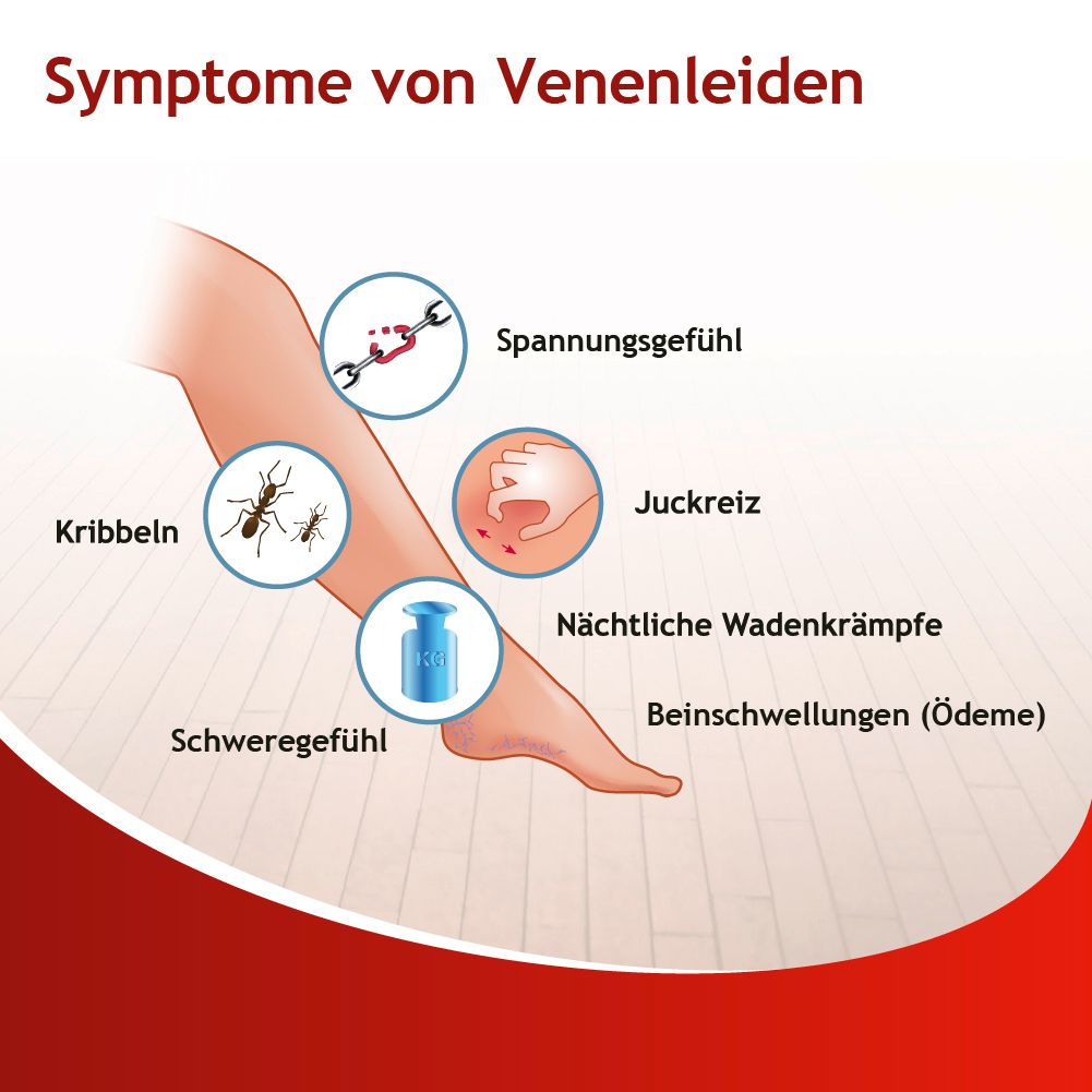 Illustration: Symptome von Venenleiden: Spannungsgefühl, Juckreiz, nächtliche Wadenkrämpfe, Beinschwellungen, Kribbeln, Schweregefühl.
