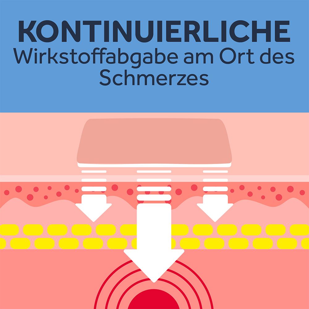 NUROFEN® 24-Stunden Schmerzpflaster 200 mg wirkstoffhaltiges Pflaster