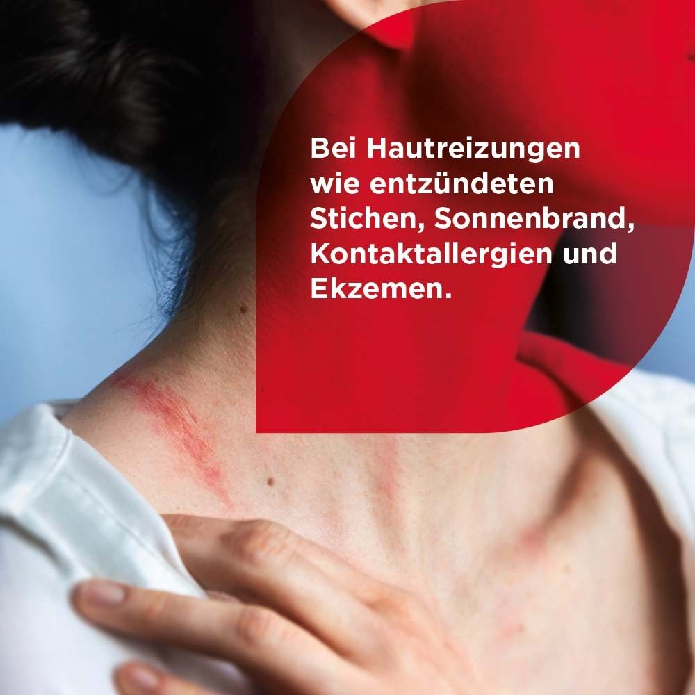 Hals einer Person mit Hautrötungen. Text: Bei Hautreizungen wie Stichen, Sonnenbrand, Kontaktallergien und Ekzemen.