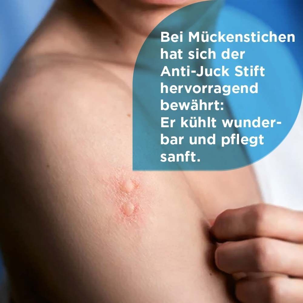 Nahaufnahme eines Oberkörpers mit Insektenstichen. Text: Anti-Juck Stift hat sich bewährt. Er kühlt und pflegt sanft.