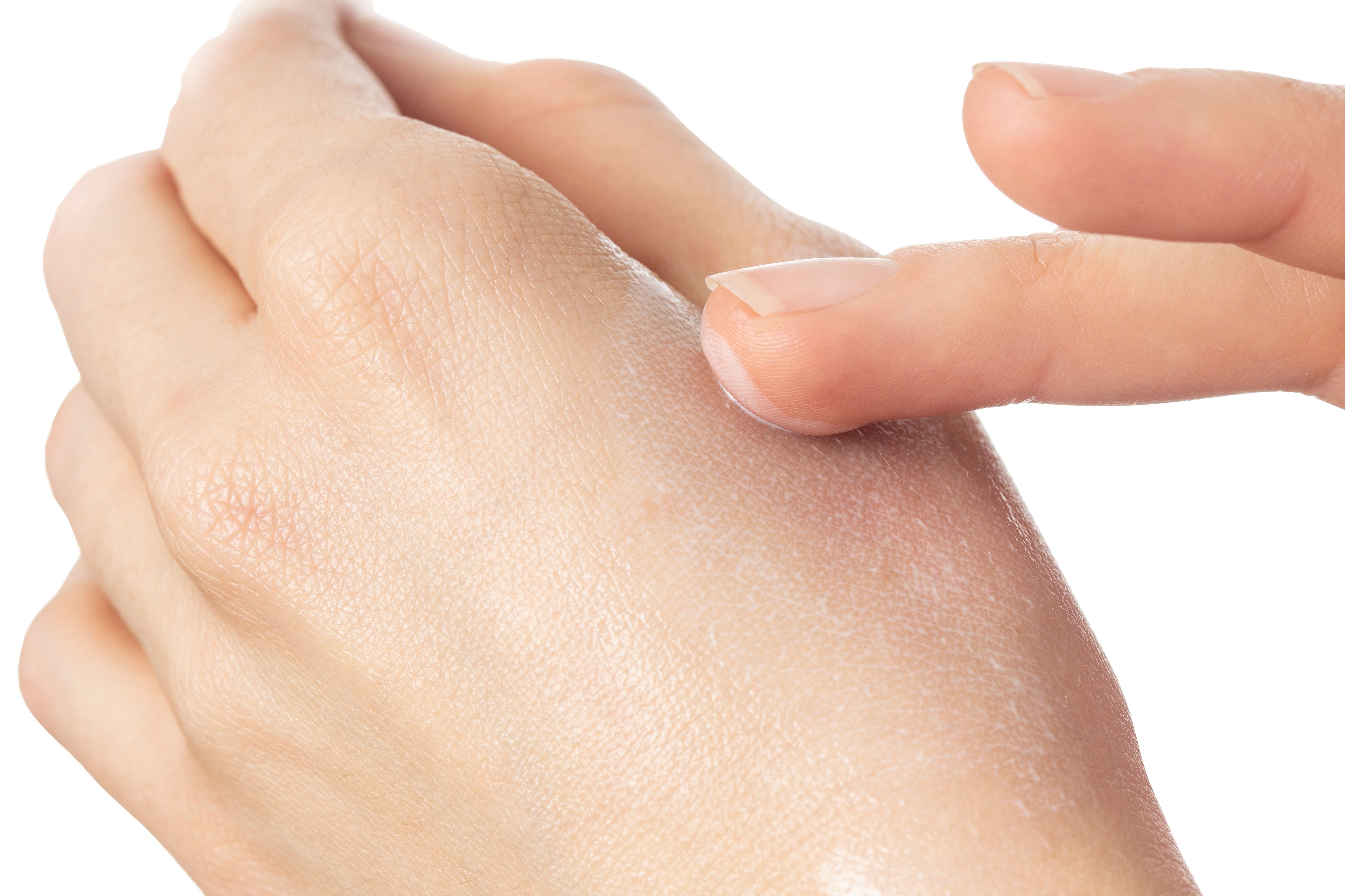 Nahaufnahme einer Hand mit Creme auf der Haut. Creme wird mit dem Finger verteilt.