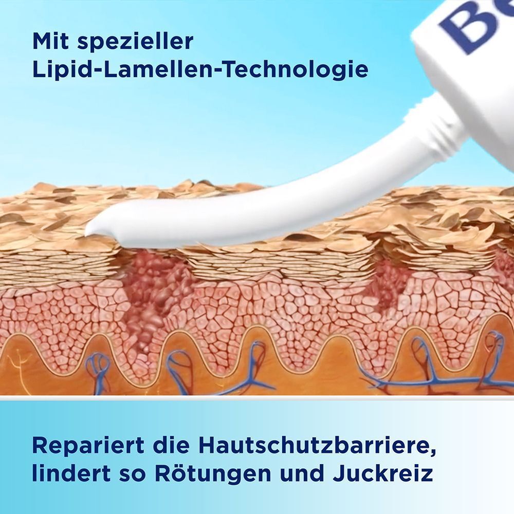 Illustration der Hautbarriere mit Lipid-Lamellen-Technologie, die Rötungen und Juckreiz lindert.
