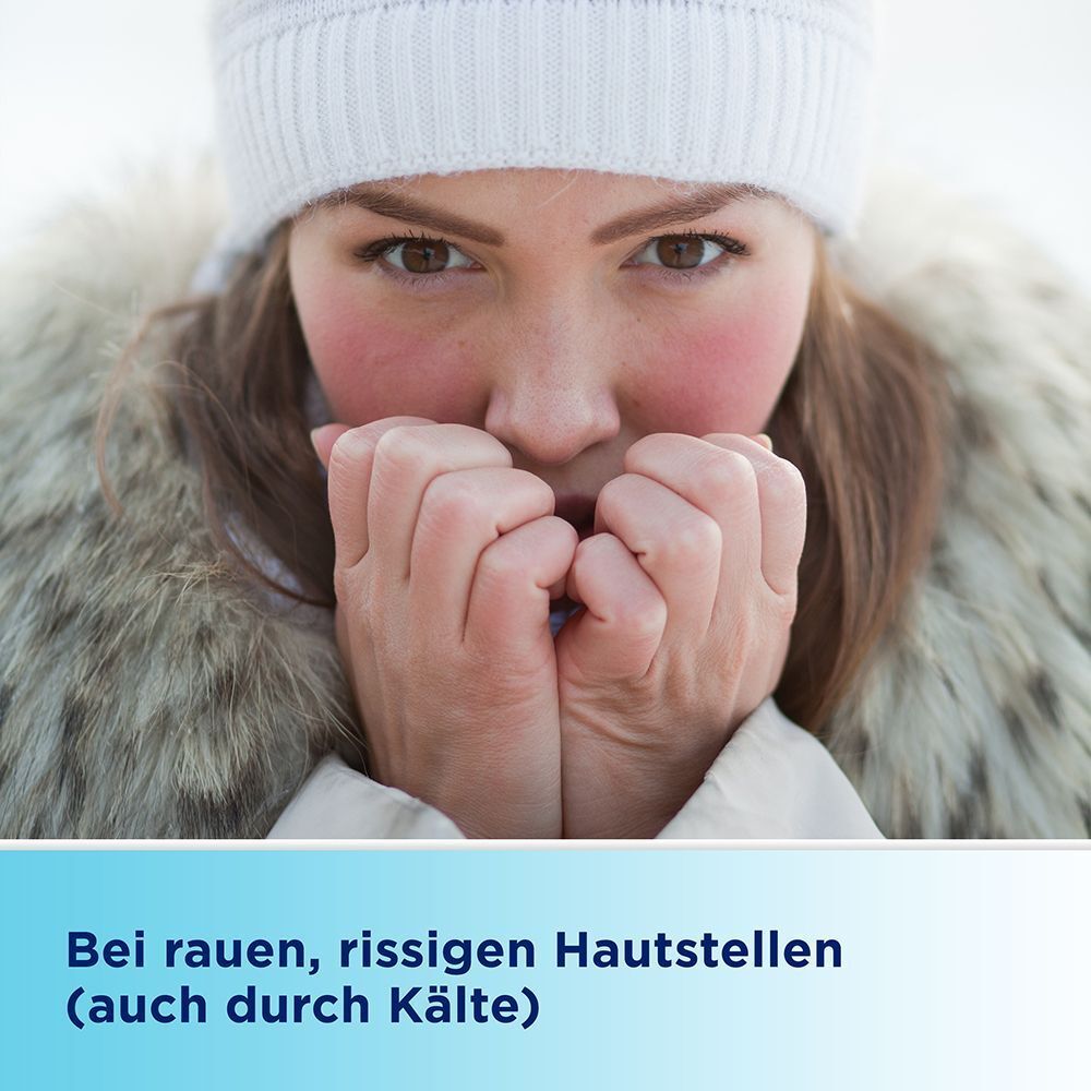 Frau mit geröteten Wangen hält Hände vor dem Mund im Freien.