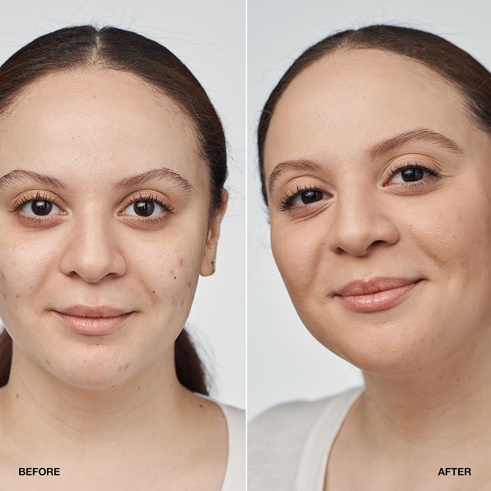 CLINIQUE Even Better Clinical™ Serum Foundation SPF 20 Neutral gegen Pigmentflecken seidig-mattes Finish