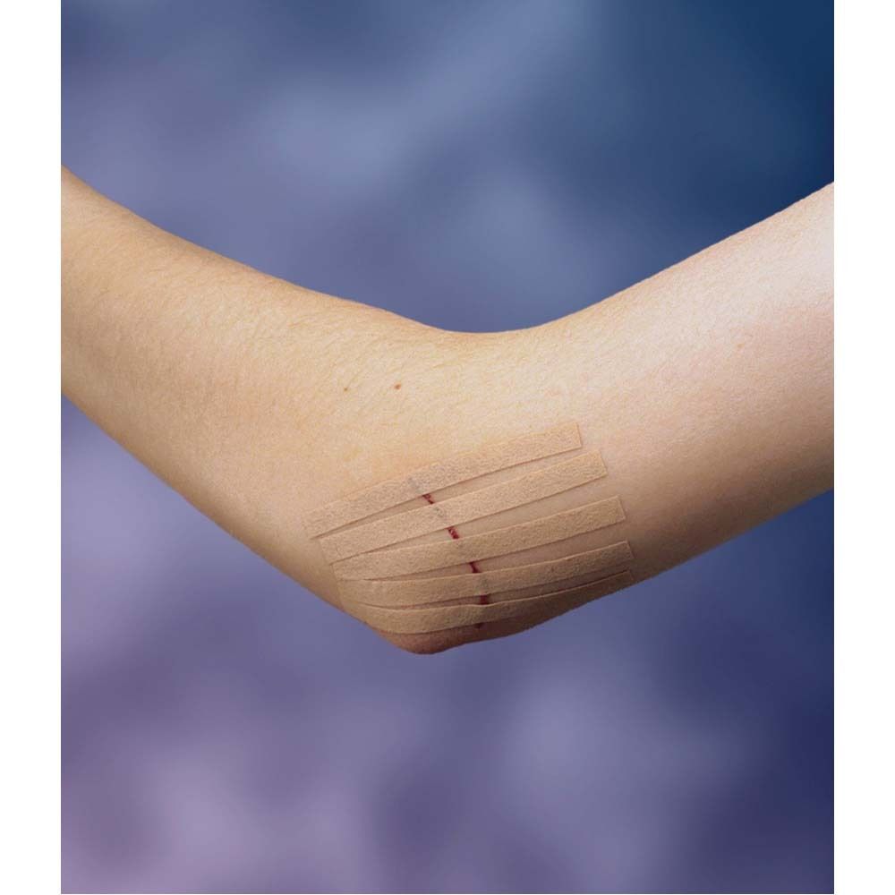 Verpackung mit Nexcare Steri-Strip Hautnahtmaterial. Enthält 6 Streifen. Größe: 6 mm x 75 mm. Hautfarben.