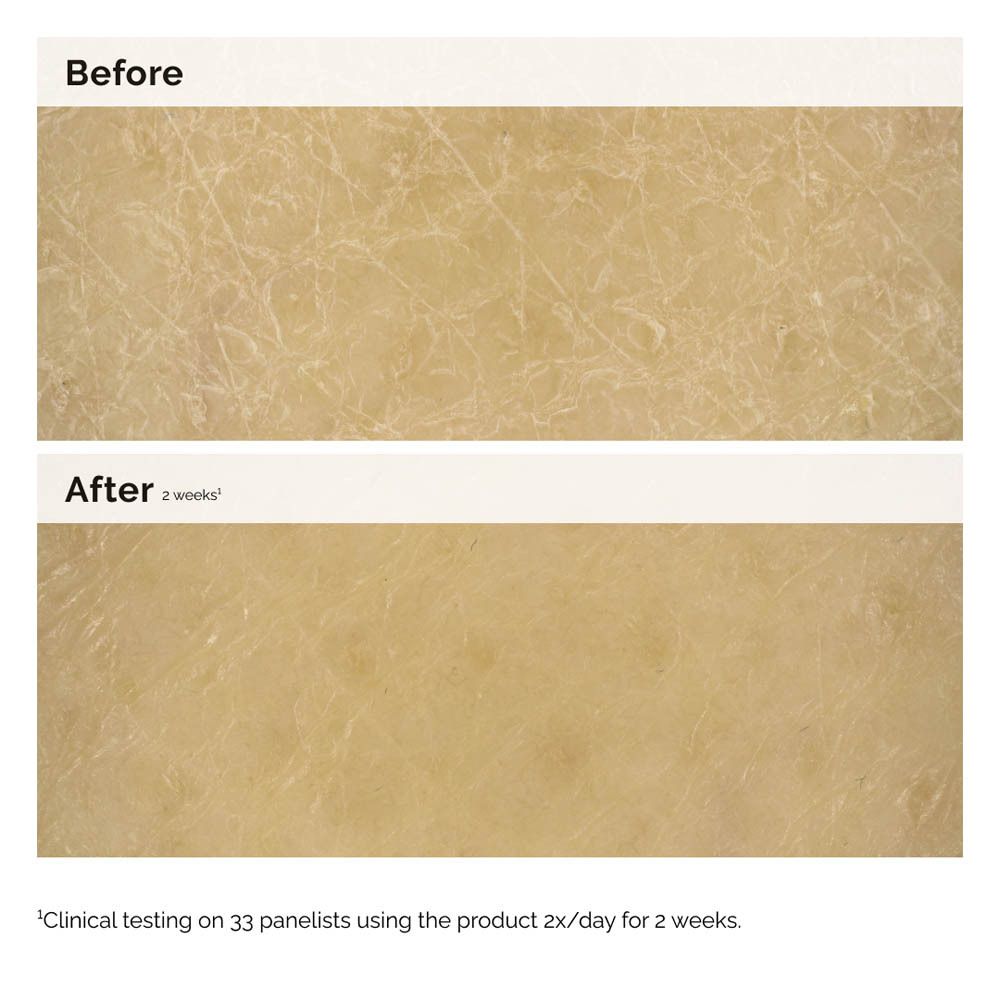 Zwei Hautbilder: Vorher und Nachher. Text: Clinical testing on 33 panelists using the product 2x/day for 2 weeks.