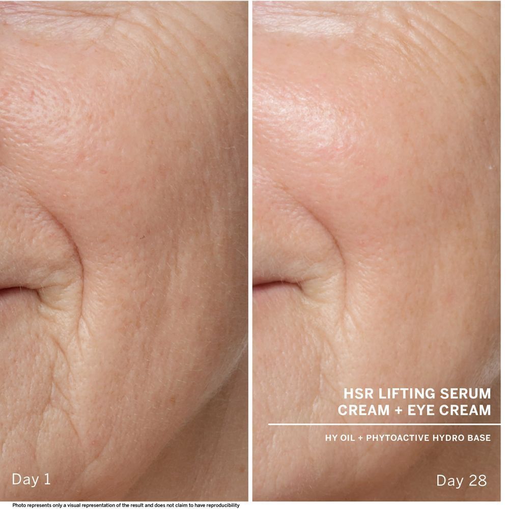 Vorher-Nachher-Vergleich von Haut. Text: HSR Lifting Serum Cream + Eye Cream. Tag 1 und Tag 28.