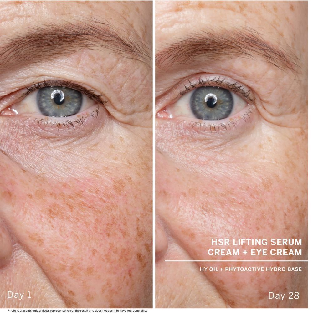 Vorher-Nachher-Vergleich von Haut. Text: HSR Lifting Serum Cream + Eye Cream. Tag 1 und Tag 28.