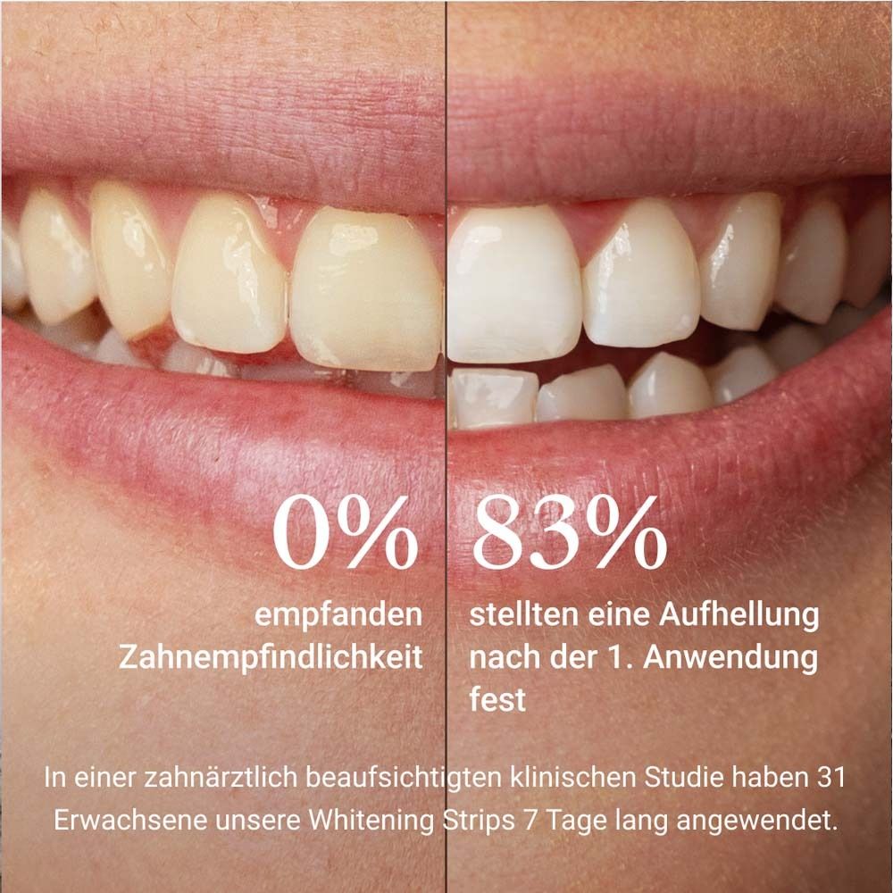 Zähne vor und nach der Anwendung. 0% Empfindlichkeit, 83% Aufhellung nach der 1. Anwendung.