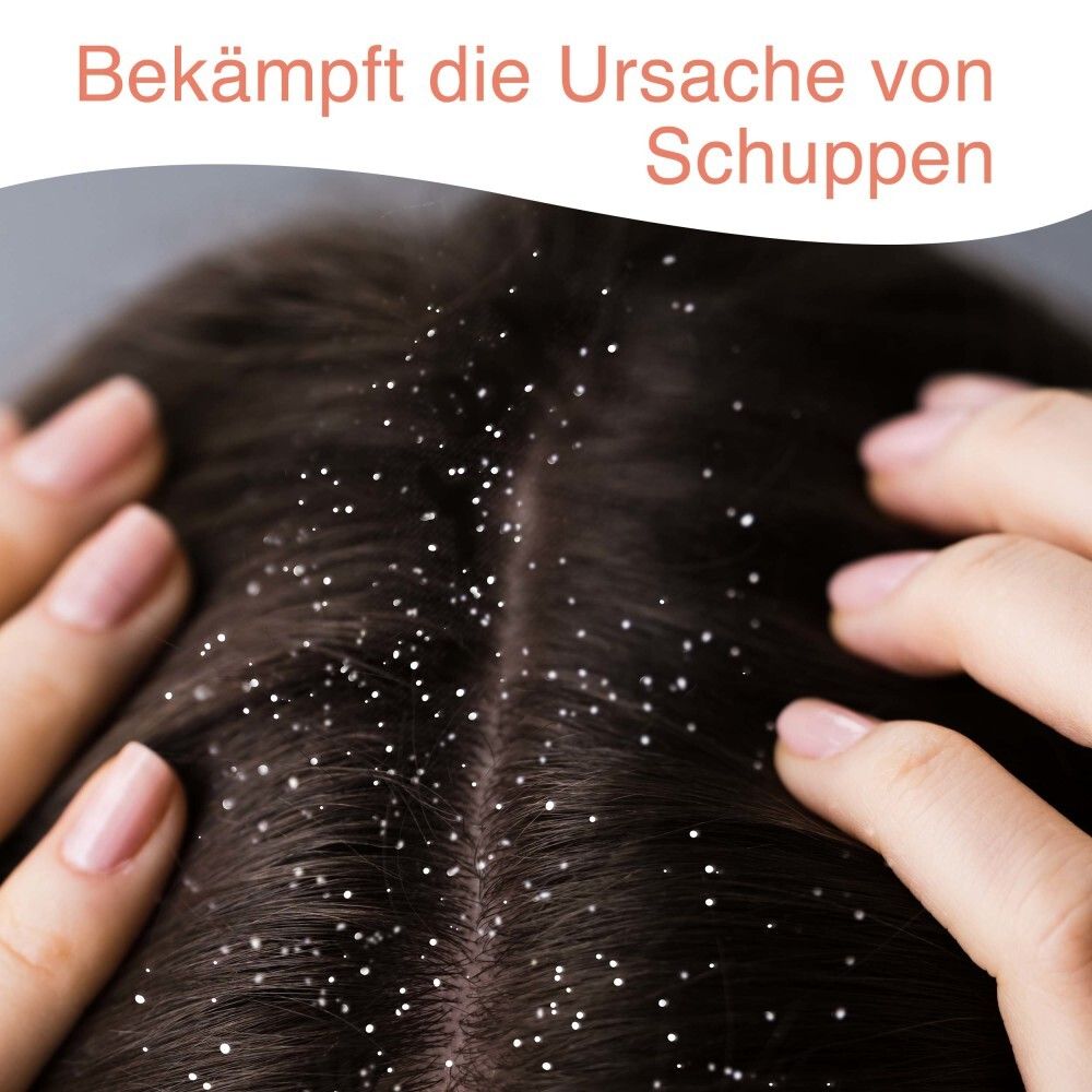 STIEPROX Intensiv Shampoo bei starken Schuppen