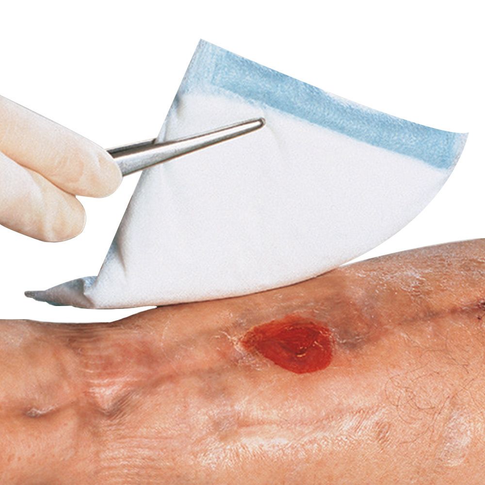 Kompresse wird mit Pinzette auf Wunde gelegt. Blaue Kante. Auf Haut mit Wunde.