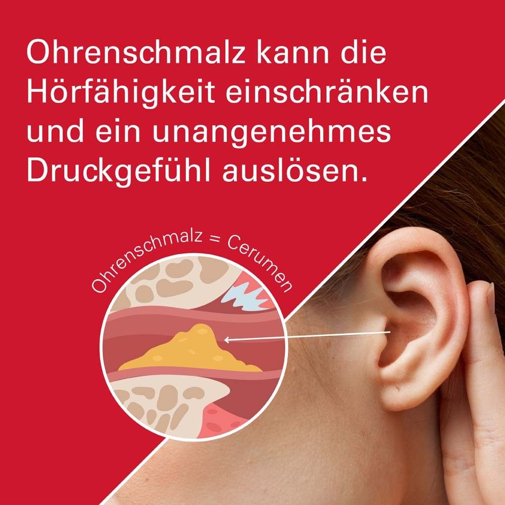 Grafische Darstellung eines Ohres mit Ohrenschmalz. Medizinische Illustration zur Veranschaulichung von Cerumen.