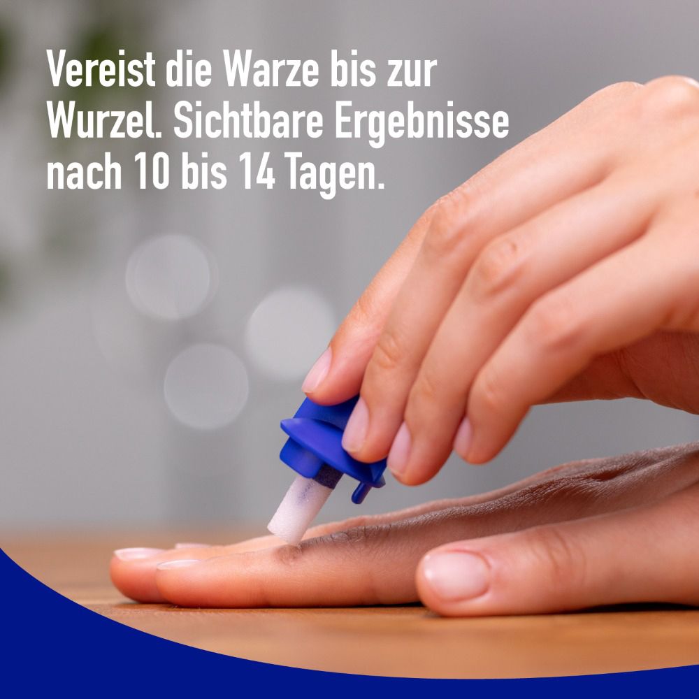 Anwendung von WARTNER® gegen Warzen. Blauer Applikator wird auf die Warze aufgetragen.