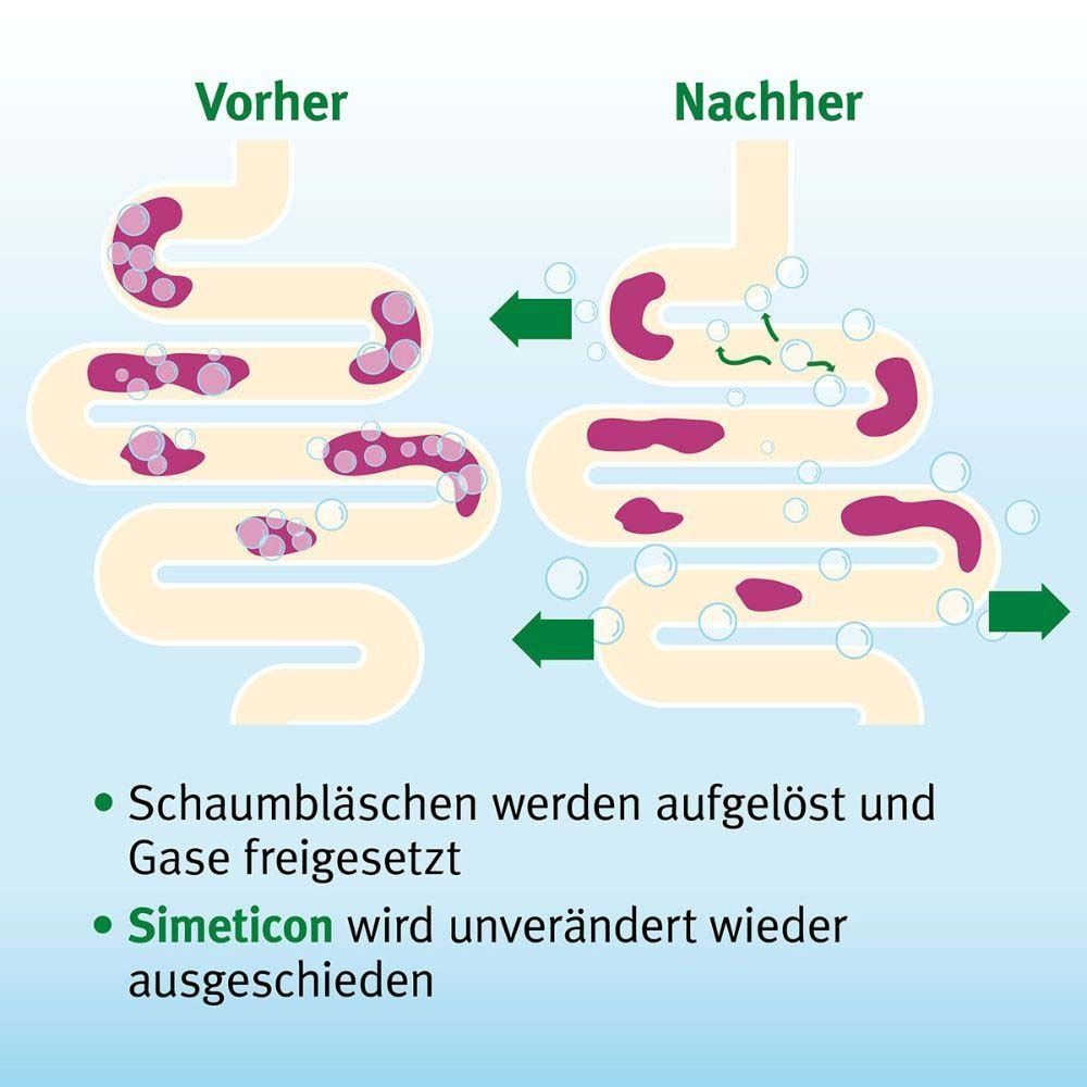 Espumisan® Gold Perlen gegen Blähungen