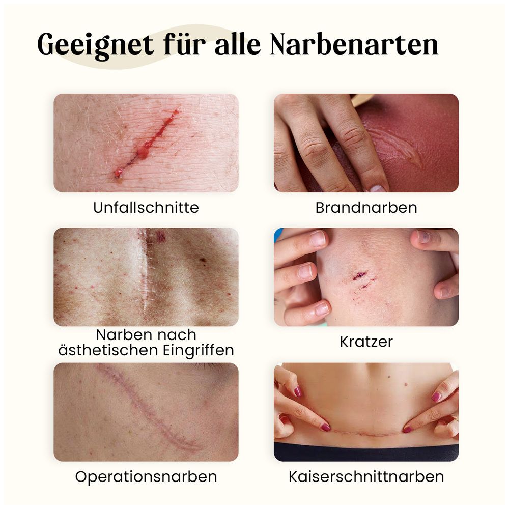 Bilder zeigen verschiedene Narbenarten: Unfall, Brand, ästhetische Eingriffe, Kratzer, Operation, Kaiserschnitt.