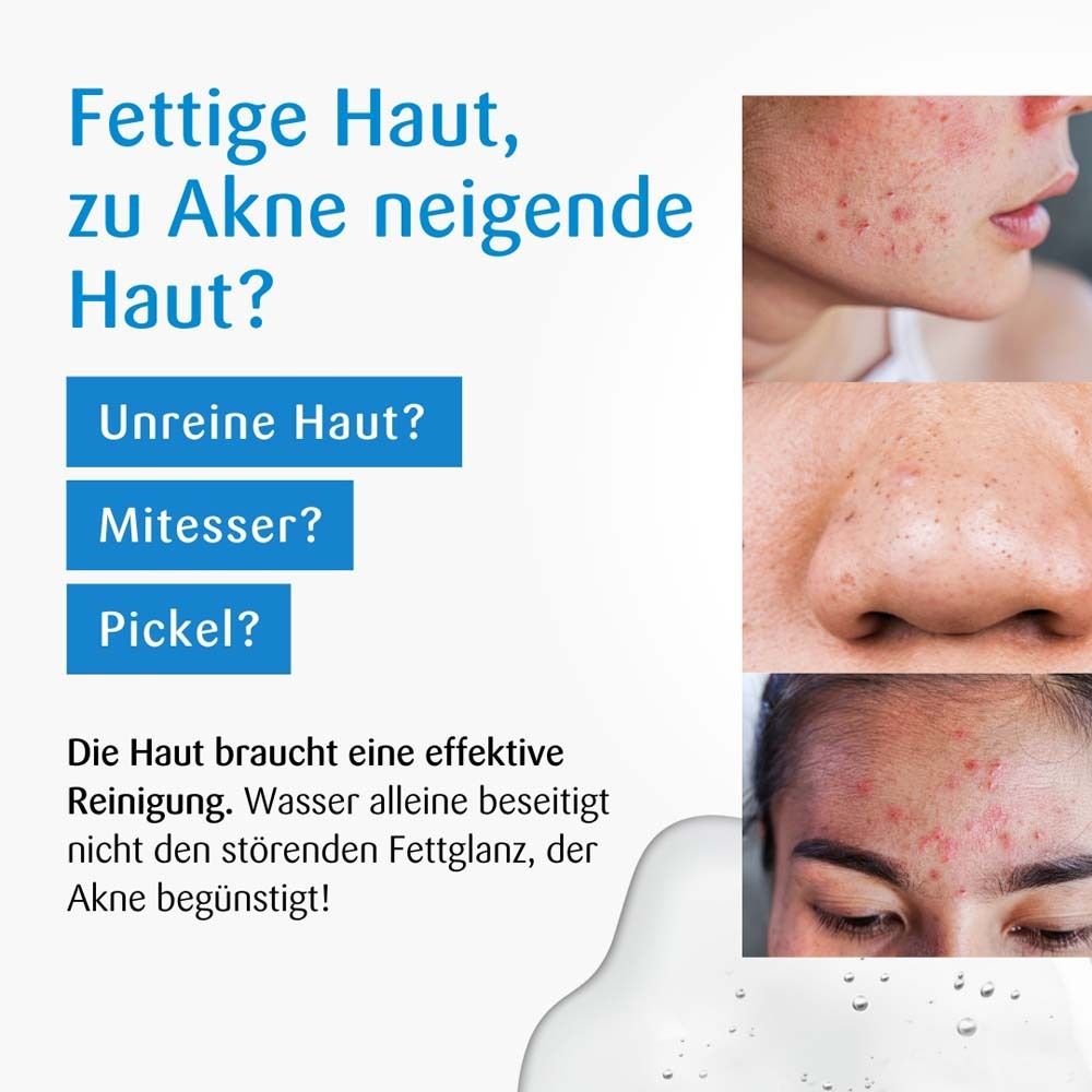 Werbebild mit benevi hydroderm Gesichts-Reinigung. Text: Fettige Haut, zu Akne neigende Haut? Bilder von Hautunreinheiten.