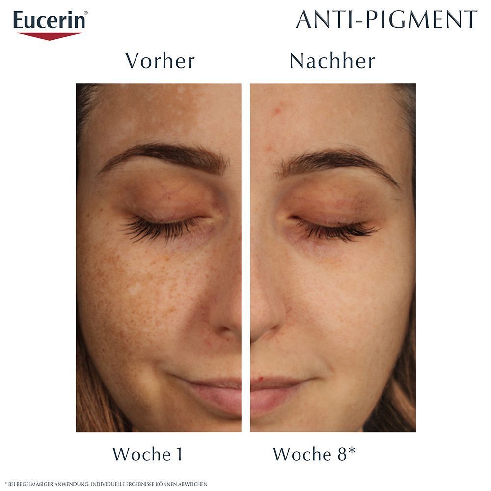 Eucerin® Anti-Pigment Pflegeset