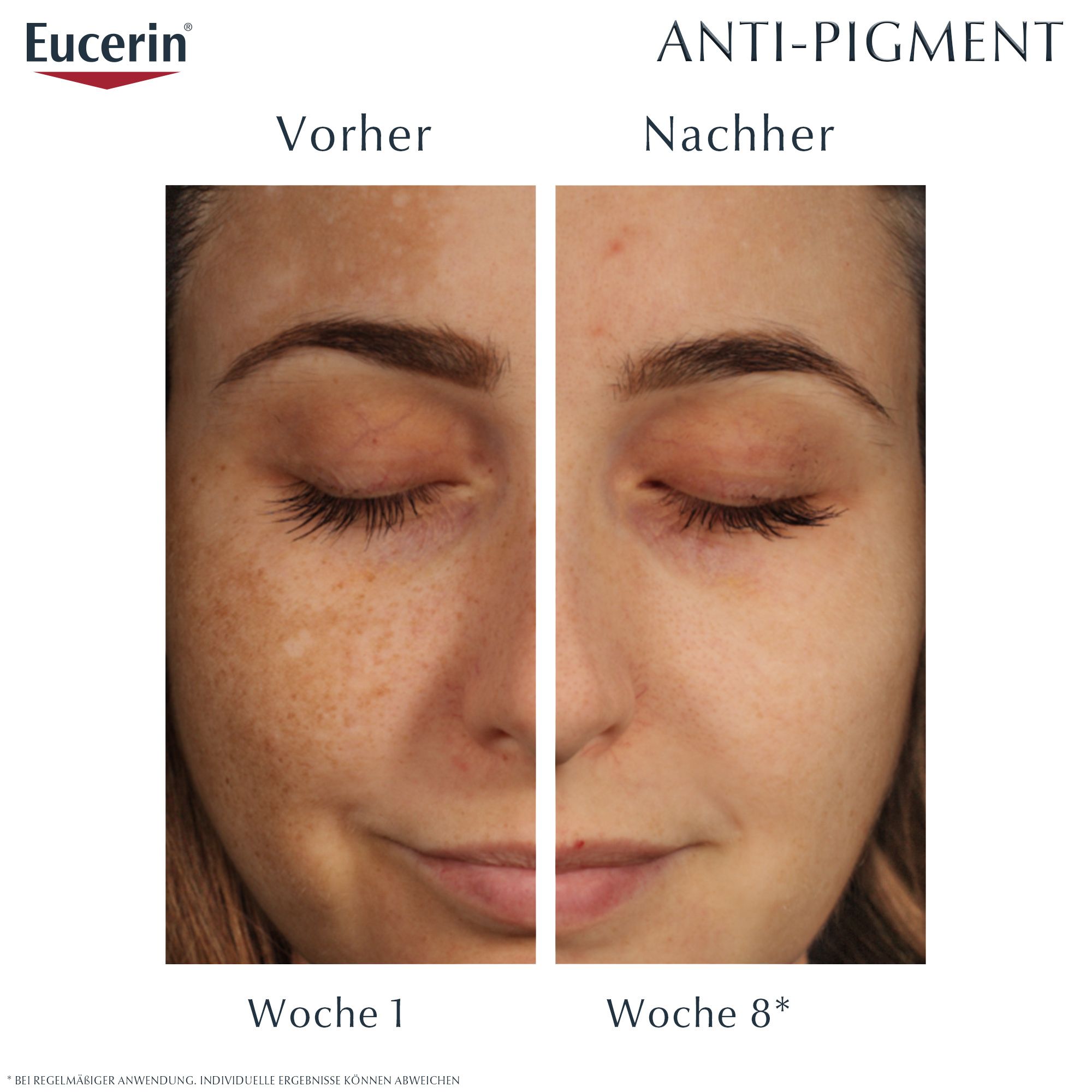 Eucerin® Anti-Pigment Korrektur-Set