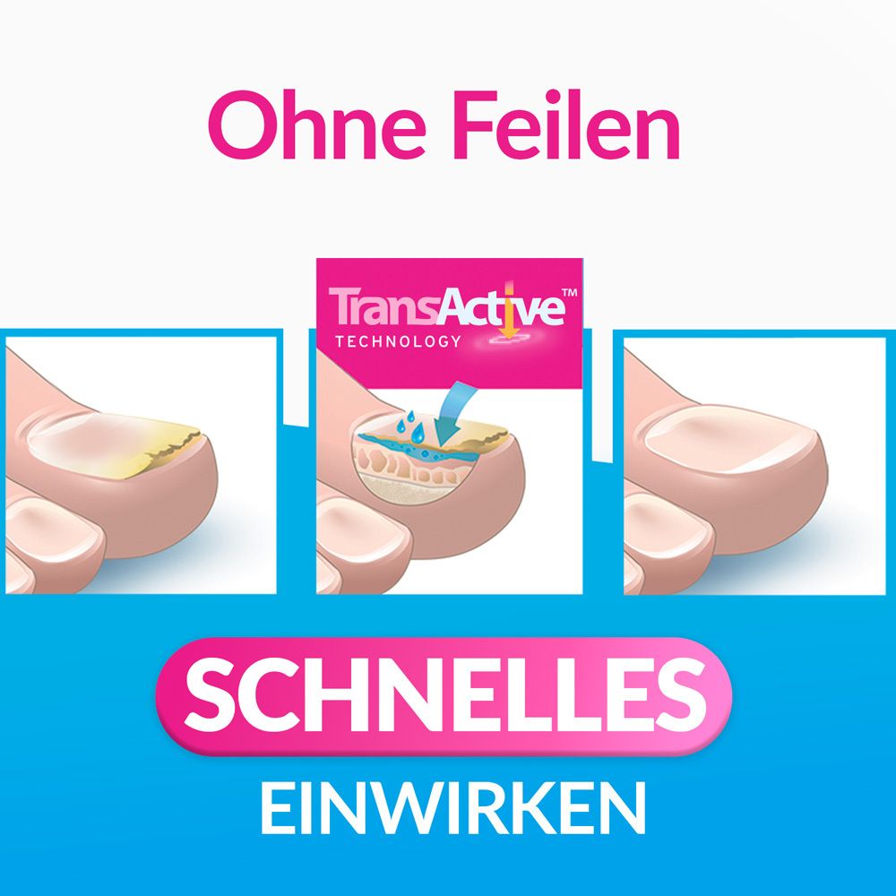 Illustration der TransActive-Technologie von Excilor zur Nagelpilzbehandlung.