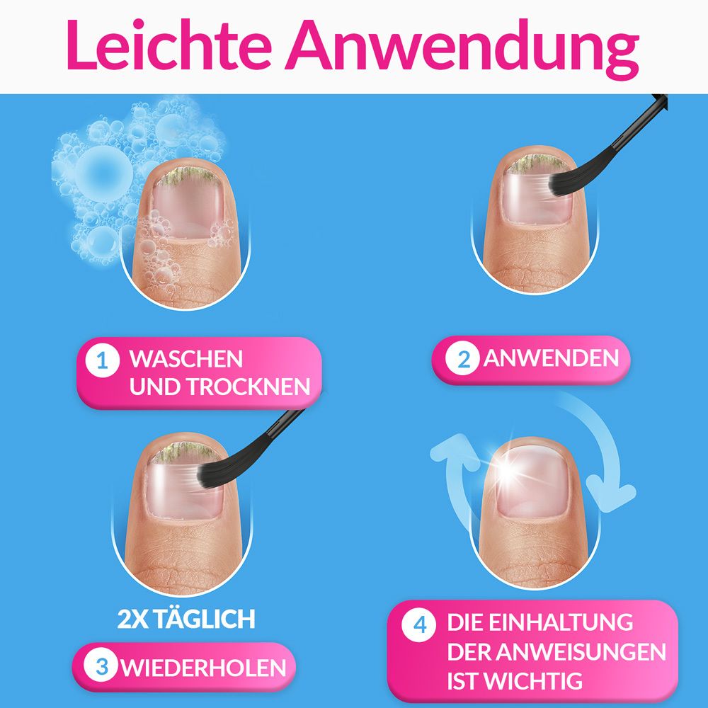 Illustration der Anwendung von excilor® Lösung gegen Nagelpilz. Schritte: Waschen, Auftragen, Wiederholen, Befolgen der Anweisungen.