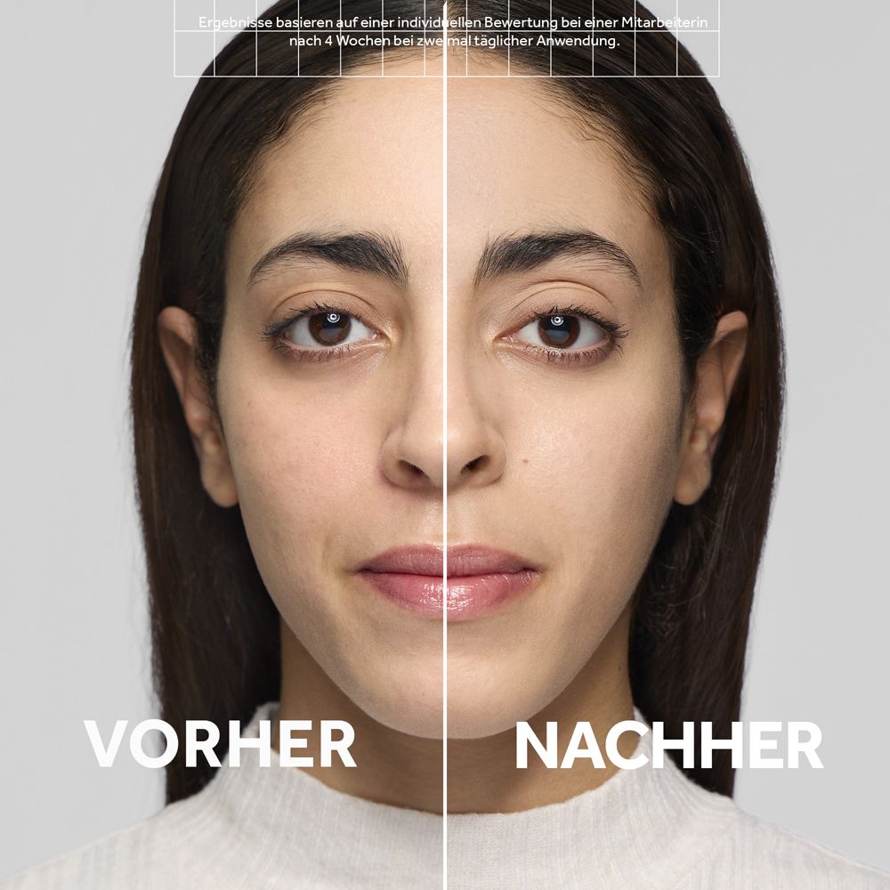 Vorher-Nachher-Vergleich einer Frau mit verbesserter Hauttextur nach Anwendung von Hautpflegeprodukten.