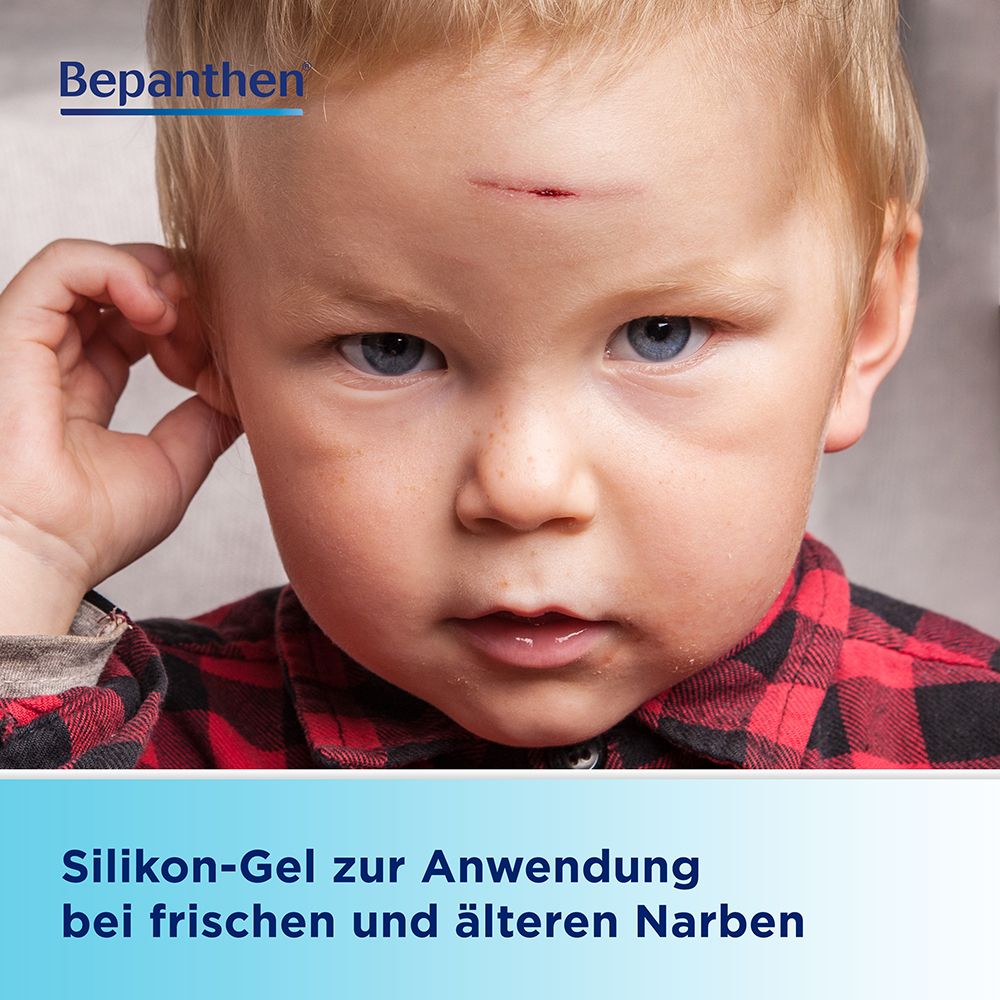 Ein Kind mit einer frischen Wunde auf der Stirn. Text: Silikon-Gel zur Anwendung bei frischen und älteren Narben.