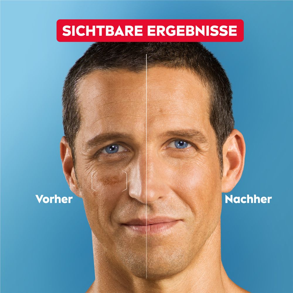 Vorher-Nachher-Vergleich. Mann mit Hautunreinheiten, dann glatte Haut. Text: Sichtbare Ergebnisse.