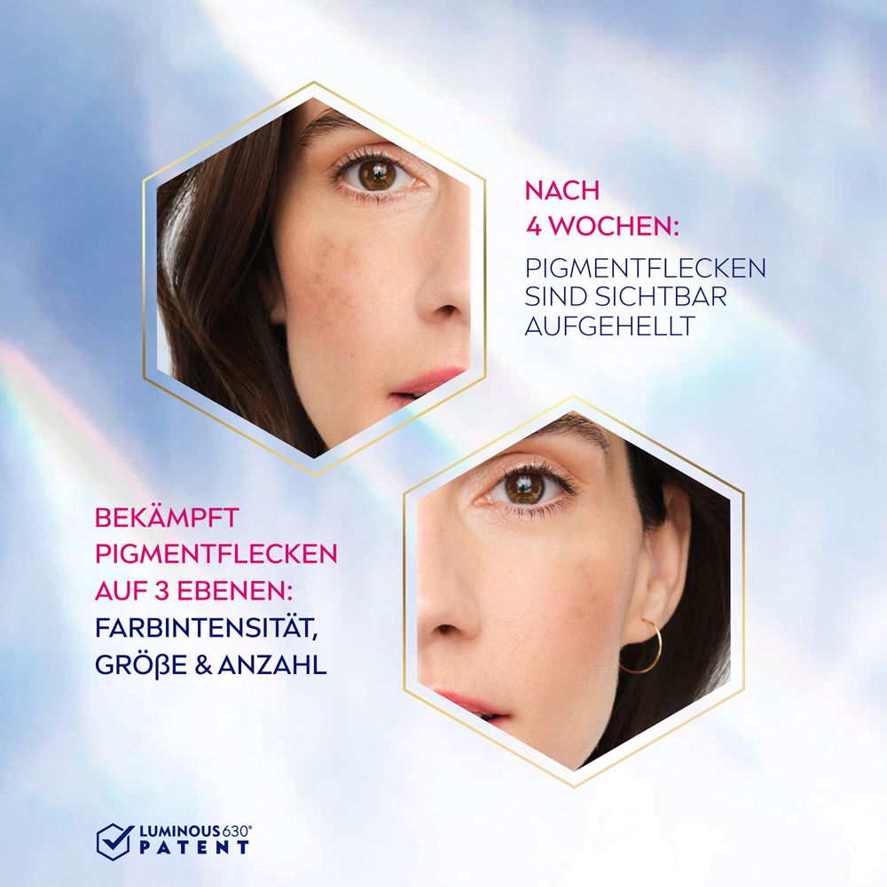 Vorher-Nachher-Vergleich. Zwei Gesichter zeigen Hautveränderungen nach 4 Wochen. Text: Pigmentflecken aufgehellt.