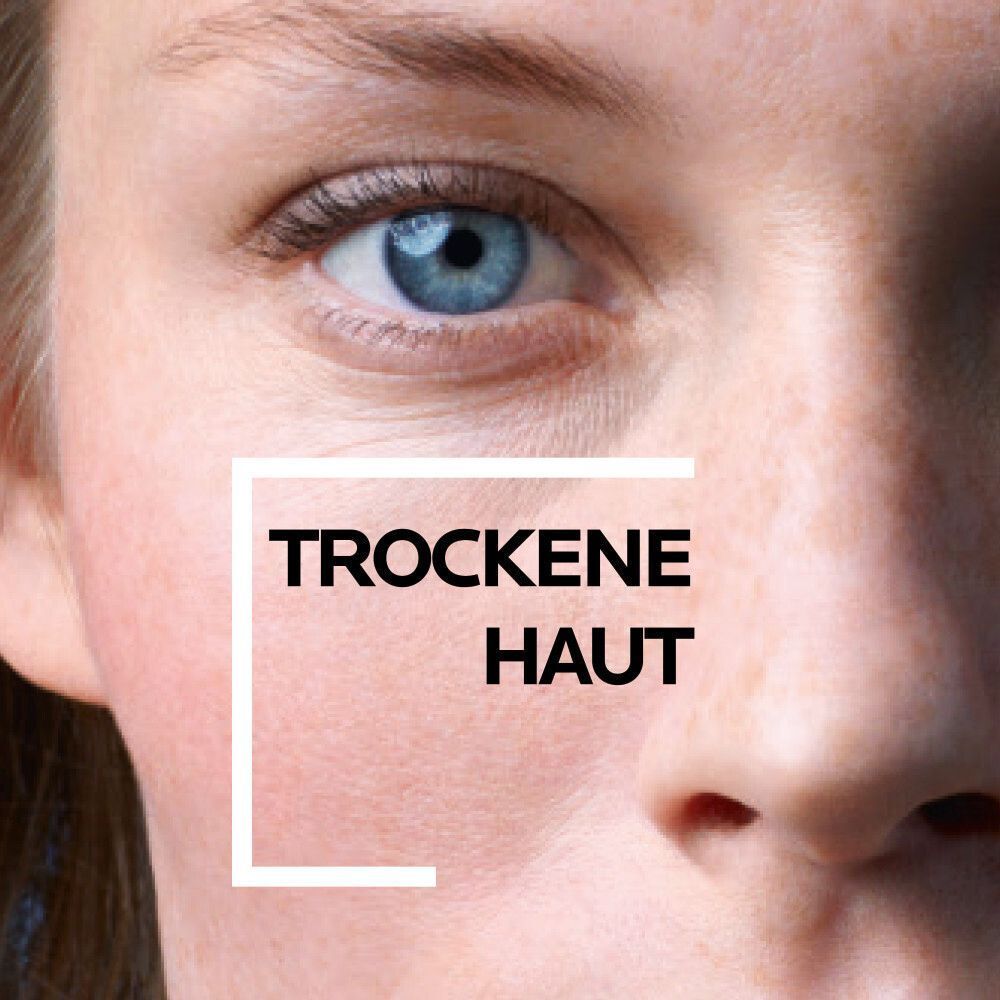 Nahaufnahme eines Gesichts. Text: Trockene Haut. Quadratische Markierung.