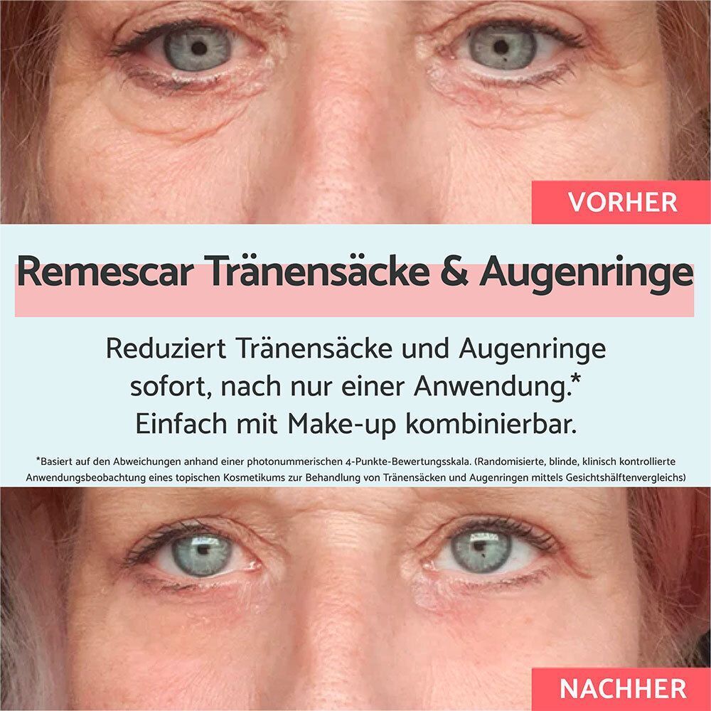 Vorher-Nachher-Bild von Augen. Oben: Augen mit Tränensäcken. Unten: Augen ohne Tränensäcke. Text: Reduziert Tränensäcke & Augenringe.