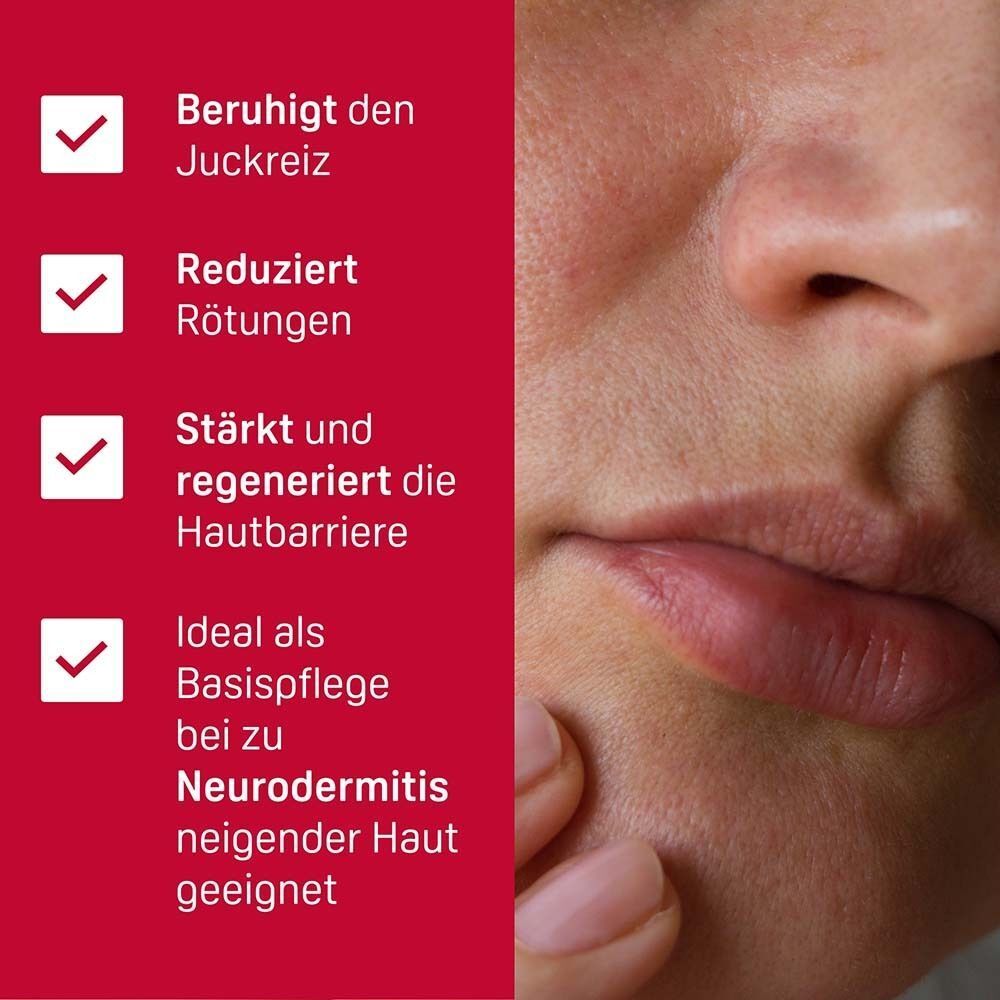 Nahaufnahme eines Gesichts. Text auf rotem Hintergrund: Beruhigt den Juckreiz, reduziert Rötungen, stärkt die Hautbarriere, ideal bei Neurodermitis.