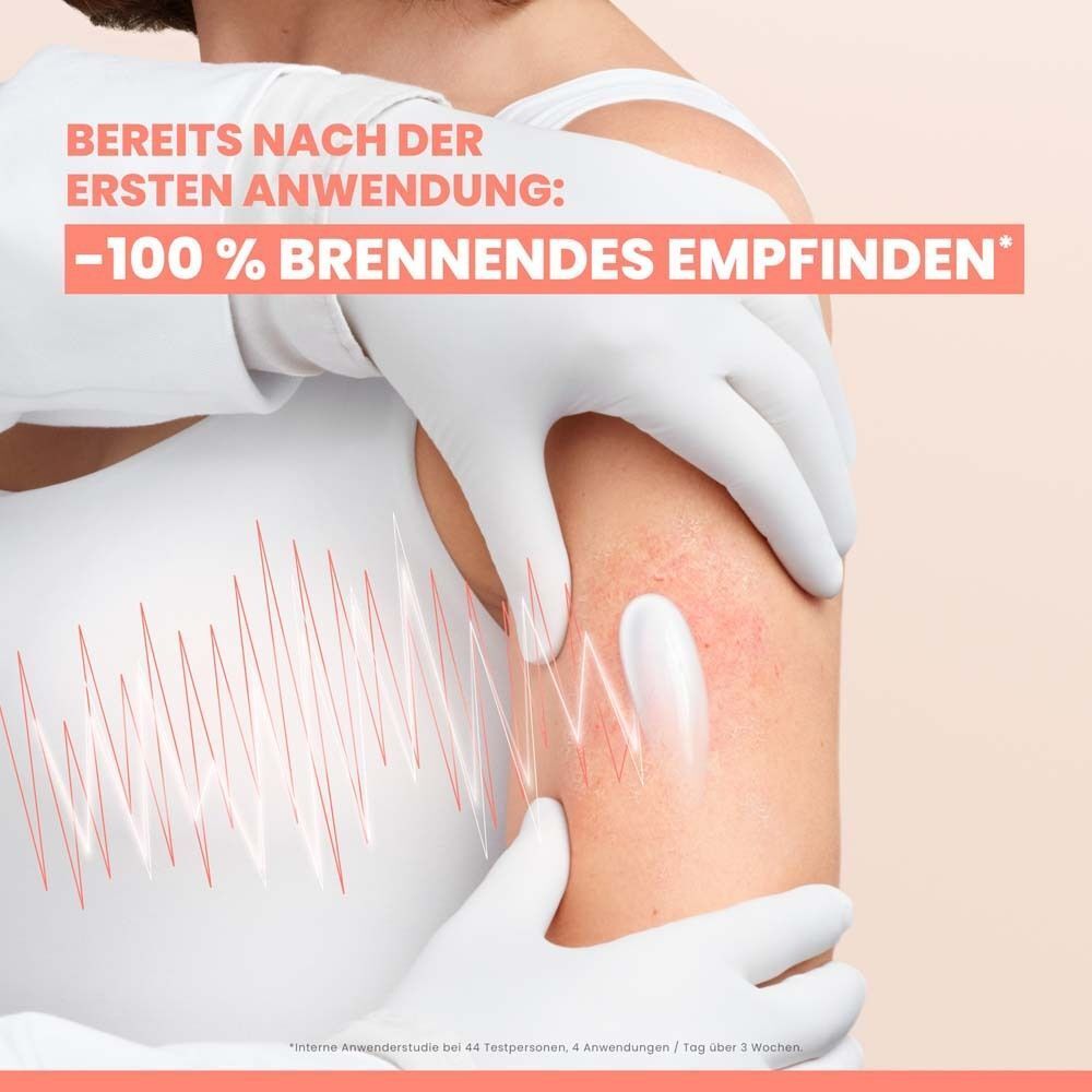 Person mit Handschuhen trägt AVENE XeraCalm A.D auf. Text: -100% brennendes Empfinden. Wellenlinien auf Arm.