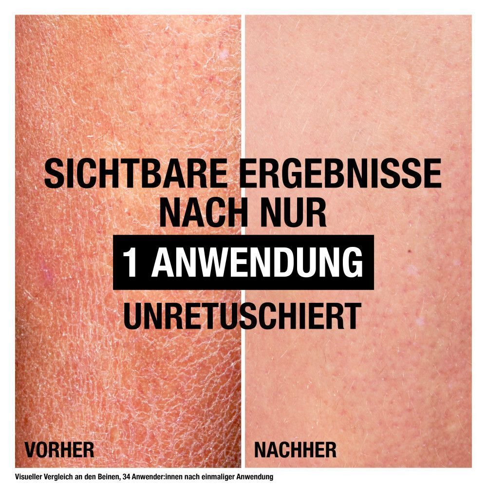 Vergleich von Haut vor und nach der Anwendung. Text: Sichtbare Ergebnisse nach nur 1 Anwendung. Unretuschiert. Neutrogena Deep Moisture.