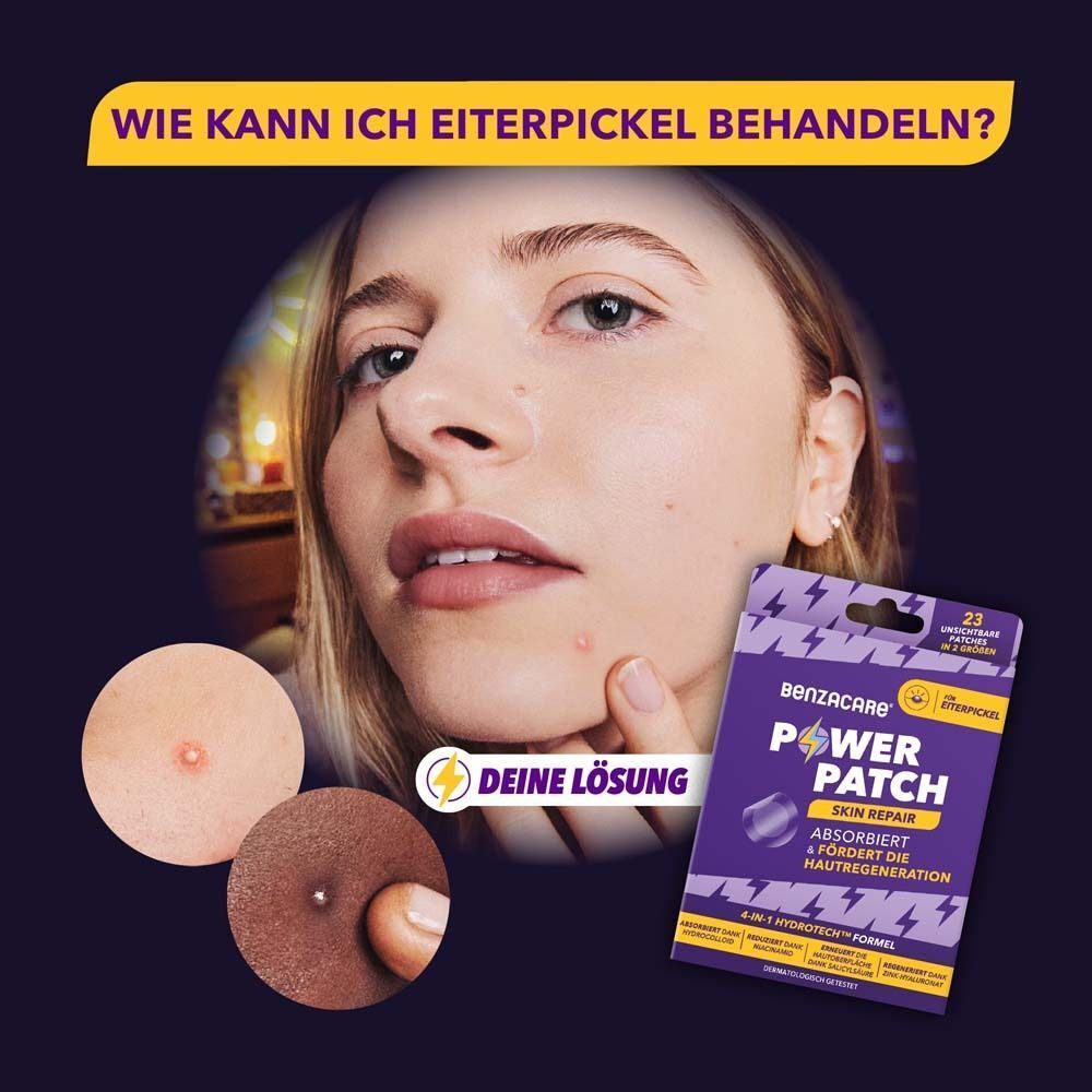 Frau mit Pickel, daneben Benzacare Power Patch. Produktverpackung mit Text. Kreisförmige Nahaufnahmen von Pickeln.