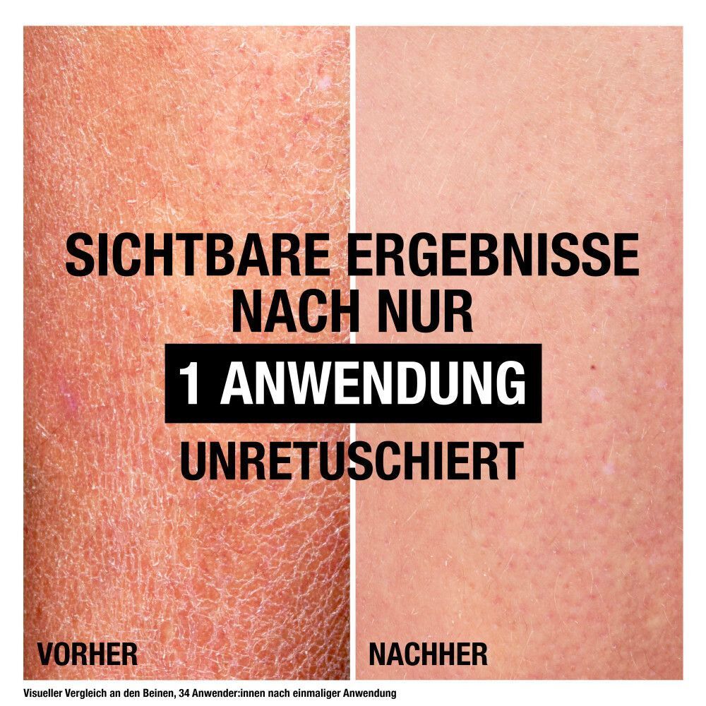 Vergleich von Haut vor und nach der Anwendung. Text: Sichtbare Ergebnisse nach nur 1 Anwendung. Unretuschiert.