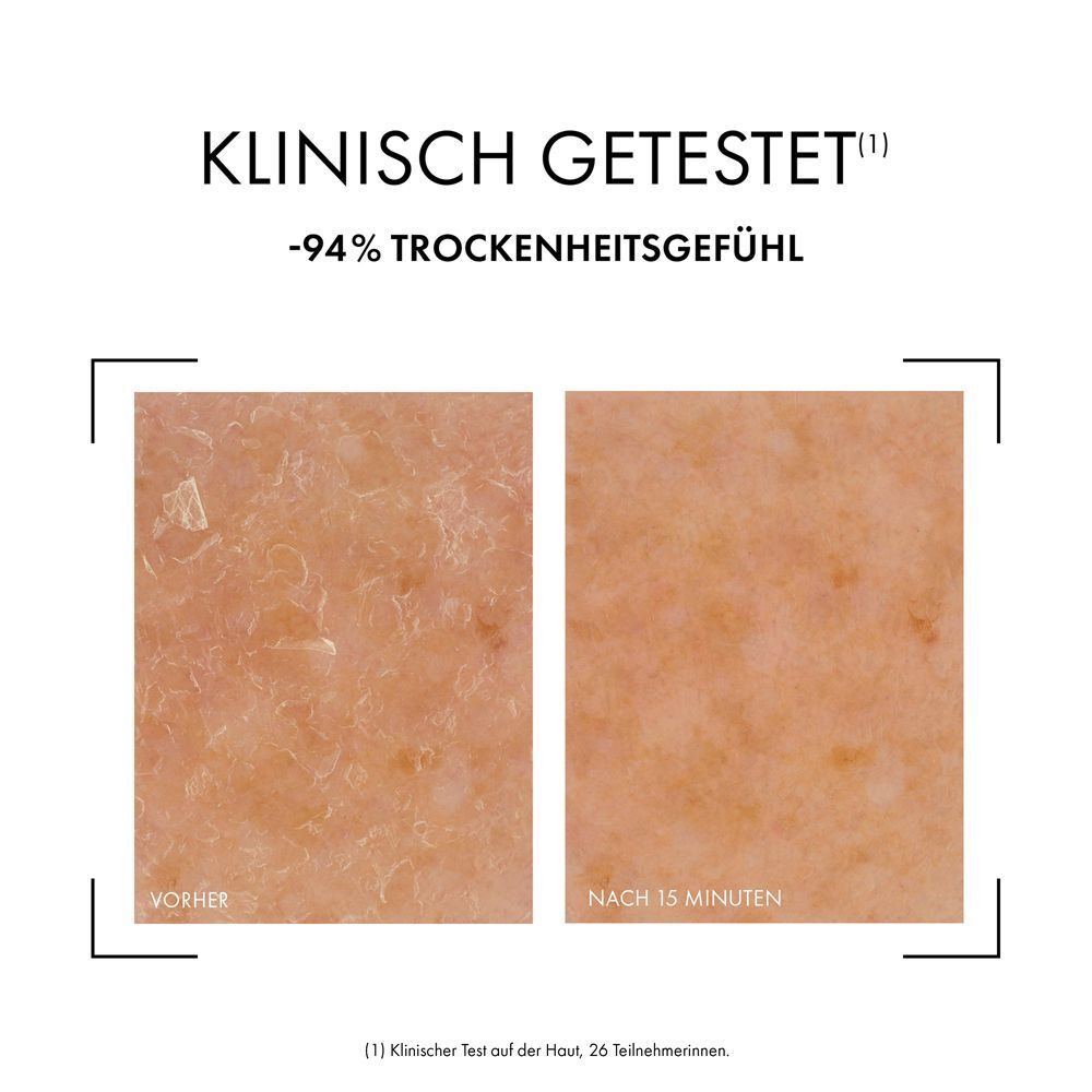 Hautbilder: Vorher und nach 15 Minuten. Text: Klinisch getestet. -94% Trockenheitsgefühl.