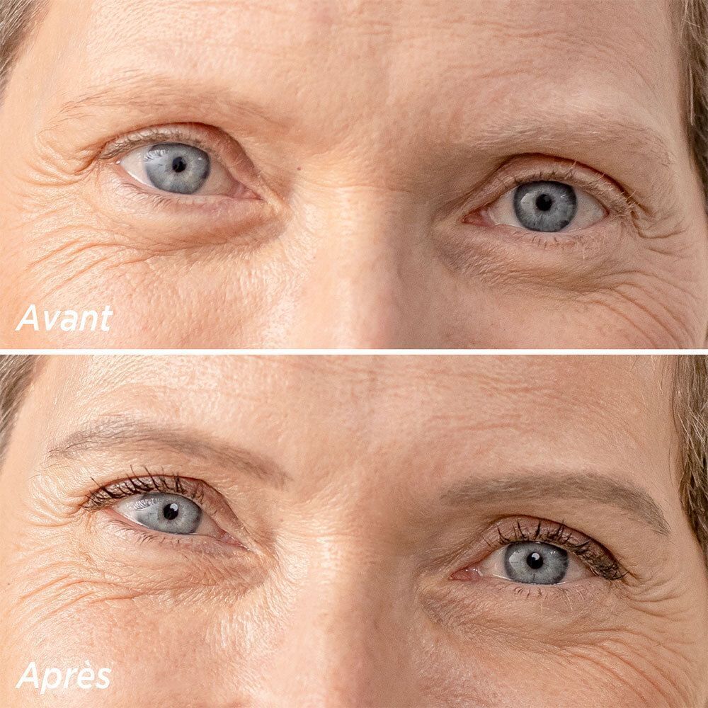 Vorher-Nachher-Vergleich von Augen. Oben: Augen ohne Augenbrauen. Unten: Augen mit Augenbrauen.